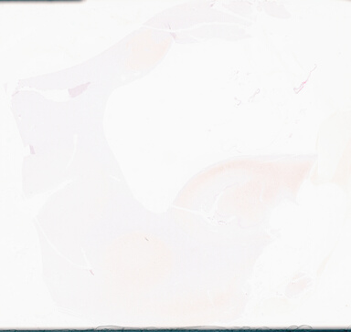 ['deident_0e3173a9-78d1-4604-9e86-e25187f51f63_69d96979.jpg']