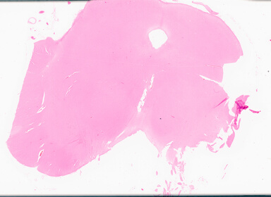 ['deident_b24f80da-4b45-4857-ab44-683528e3210f_69d969d5.jpg']