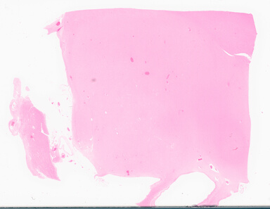 ['deident_e532dada-03b8-4cf4-b86b-e4655f809d14_69d969f7.jpg']