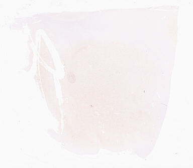 ['deident_f00e7c25-c45c-45b4-a1c6-b8afea4fb1ed_69d96a00.jpg']