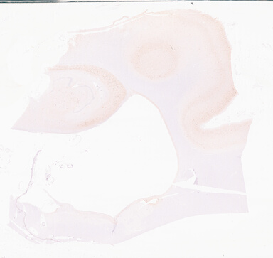 ['deident_6a622d60-6d9a-47dd-bb6f-92f1696a703b_69d969ae.jpg']
