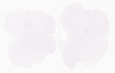 ['deident_a5a77b8a-8115-4444-b27a-3212762bb24b_69d969cc.jpg']