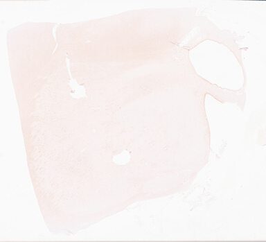 ['deident_cc698179-fa30-4523-8c39-e9546482e6f9_69d969e2.jpg']