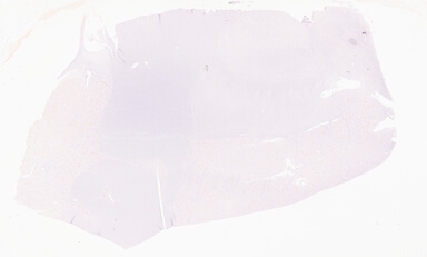 ['deident_106ebda2-1095-483b-88f7-42dfc1216265_69d9697a.jpg']