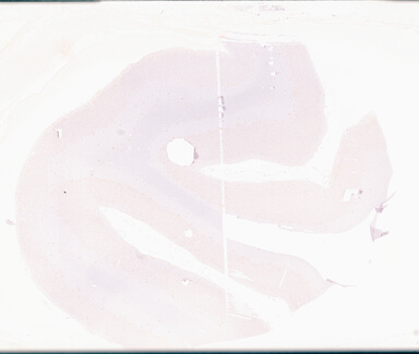 ['deident_f9f11a23-0a7d-4933-95ac-79713a5cd51e_69d96a09.jpg']