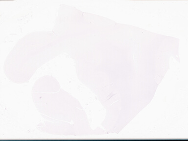 ['deident_50b89a41-e4b6-4321-91a0-e07c19df0c3a_69d969a3.jpg']