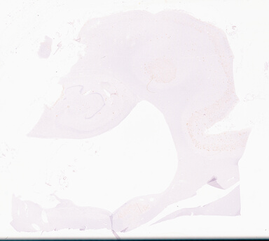 ['deident_25f31d06-e352-465c-89e4-a163907e1ab0_69d9698b.jpg']