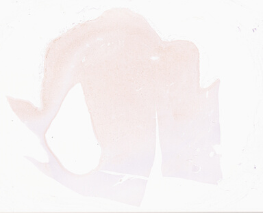 ['deident_b75457a1-45c7-4d71-a246-6a362bac41f0_69d969d7.jpg']