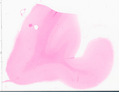 ['deident_89ebbfc7-325b-4b0c-b544-fbe17e699979_69d969bd.jpg']