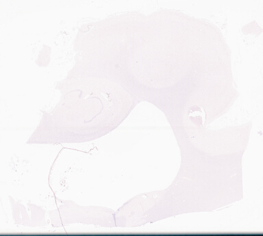 ['deident_17646124-a66b-4b1f-a09a-dc32939bec0e_69d9697e.jpg']
