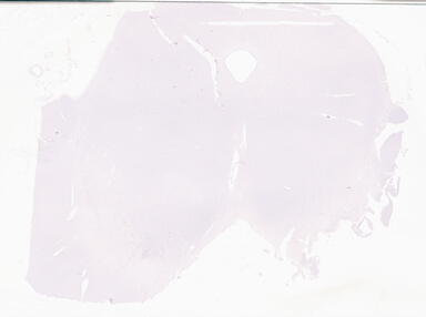 ['deident_c9027492-2f86-4432-97e2-ac6fe610b5c0_69d969e1.jpg']