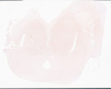 ['deident_069a813e-c906-4470-a0e2-03020945ca40_69d96972.jpg']