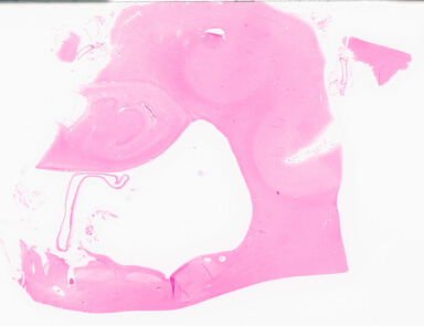 ['deident_5f5d2841-ac89-48c6-87c3-e7b435d0c767_69d969aa.jpg']