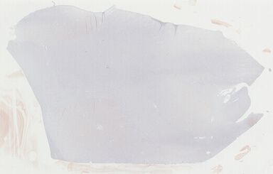 ['deident_ef3fb460-eb81-4468-9418-9e960d3d7071_69b048ca.jpg']