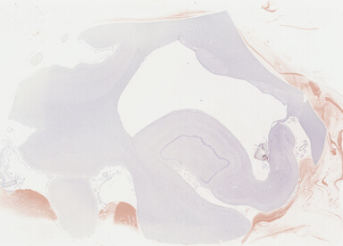 ['deident_936ce68a-2e99-4c8e-9e70-b05a5b736f42_69b048a9.jpg']