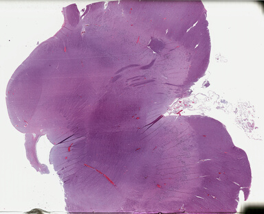 ['deident_885d864c-3df3-4716-9d14-2973c434f23e_69b048a6.jpg']