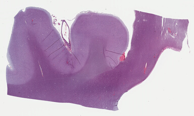 ['deident_a34b61c1-75a6-4f08-93b5-dbd6b85871c5_69b048b2.jpg']
