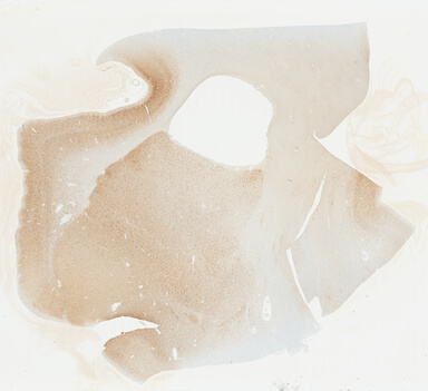 ['deident_d1183ef1-45c9-4091-9c0b-a678031c9b34_69b048c3.jpg']
