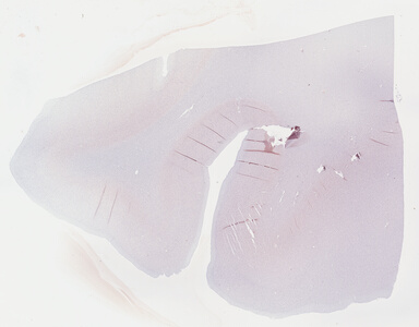 ['deident_bd9909b8-e9f4-4d01-8439-bae9f78dd348_69b048b8.jpg']