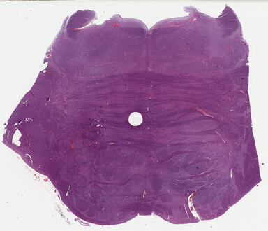 ['deident_9cd7fa70-0eb8-46a9-84e9-ef6e0b3beca2_69b048ad.jpg']