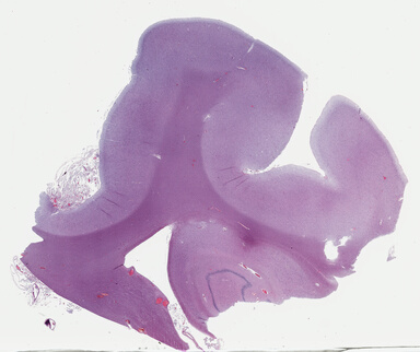 ['deident_9897ba25-a861-40f6-a29c-db4022cb2f33_69b048ab.jpg']