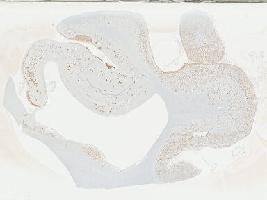 ['deident_655a3b24-b122-472f-8886-607354386d7f_69b048a1.jpg']