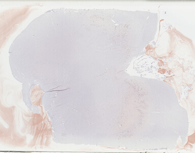['deident_f9b57e52-f6d7-4b47-8a33-bf1e1774b4b8_69b048cd.jpg']