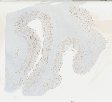 ['deident_4e06d022-85e0-4678-a504-7c8b9a273c88_69b0489f.jpg']