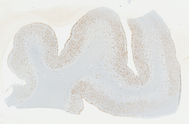 ['deident_eb939013-773c-4dfd-ab66-28f551b05fae_69b048c8.jpg']