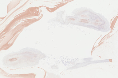 ['deident_2affb45b-5ec4-46d4-a435-0a7341e91d91_69b04891.jpg']