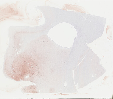 ['deident_aef6dc5f-a19f-4226-bae9-ea7ec4188a3e_69b048b5.jpg']