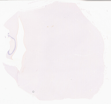 ['deident_1aa791e2-d5a7-42a4-bced-f75994a6105b_69b039c1.jpg']