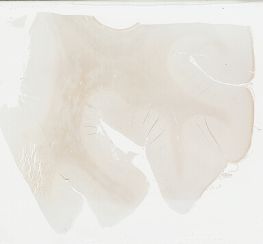 ['deident_94aa6225-c172-4cb7-9c9f-528f5998cc18_69b039ef.jpg']