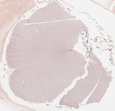 ['deident_19e01365-702c-440d-a03d-e83ea2effc10_69b039bf.jpg']