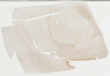 ['deident_027a3d33-77cd-4dc1-b28f-7ea24f5ac4fc_69b039af.jpg']