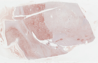 ['deident_4507293b-6d57-4bd5-9e6a-b58a582fb414_69b039ce.jpg']