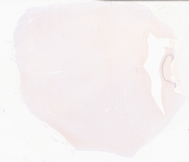 ['deident_a9e746b9-9421-49bb-b1ad-7cf1c2b23855_69b039f4.jpg']
