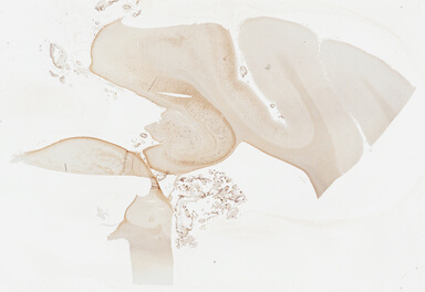 ['deident_80ff66ea-0a2f-488e-9ff0-a4d3e73bb6b7_69b039ed.jpg']