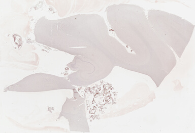 ['deident_d177de2b-eb72-4ff7-824f-eb301c4219fd_69b03a06.jpg']