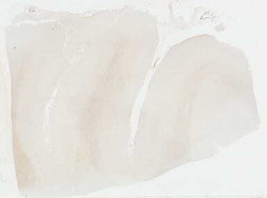['deident_0a81eed5-50f8-4847-82bb-da5f03eab864_69b039b8.jpg']