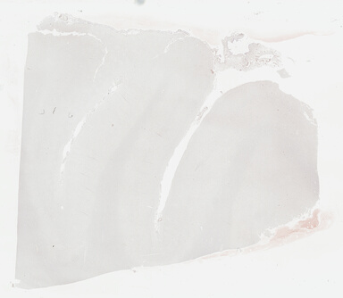 ['deident_39e4f23e-4450-49c6-8fc8-6386c61048c9_69b039cb.jpg']
