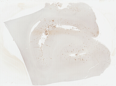 ['deident_d79e2dd5-d9d1-46d9-9a86-bbda3e27a3c9_69b03a09.jpg']