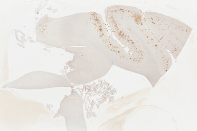 ['deident_dd80b39d-e9ac-4069-9827-f0fe6e284ef5_69b03a0e.jpg']