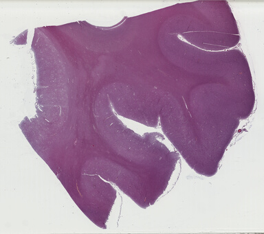 ['deident_49521572-1ccd-4acc-aa49-ab86c80ad568_69b039d5.jpg']