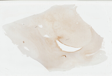 ['deident_cc4a64fa-5b2e-45ac-88f3-fe17890e9bfd_69b03a03.jpg']