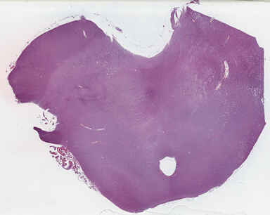 ['deident_0a3ac761-471f-4c19-aaef-facfdde6251f_69b039b6.jpg']