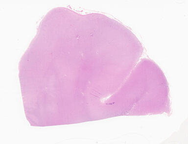 ['deident_dfe3a91d-0b3f-4b33-9a77-8fc7b61f5875_69d94a23.jpg']