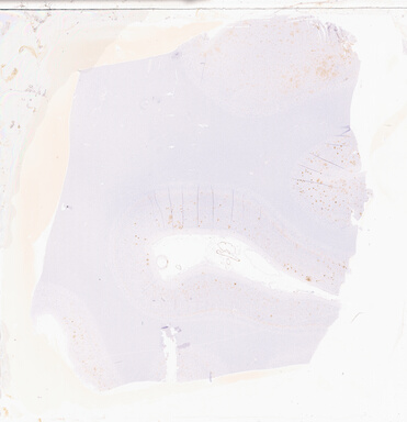 ['deident_5b51c49c-e923-4cd8-9407-ebb1d977c7a8_69d949de.jpg']