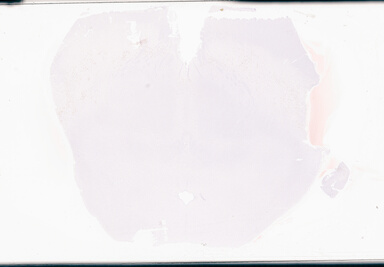 ['deident_260032b5-b0cf-4973-b65c-8f2902a531ef_69d949c7.jpg']