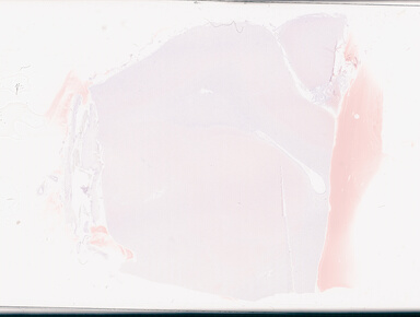 ['deident_8d308410-3dee-4a04-ae85-a8726ffb4061_69d949f8.jpg']